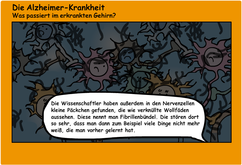 Comic: Nervenzellen, die sich bei der Alzheimer-Krankheit nur zum Teil miteinander verständigen können.